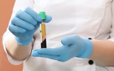 Platelet-Rich Plasma Therapy: A Natural Approach to Healing